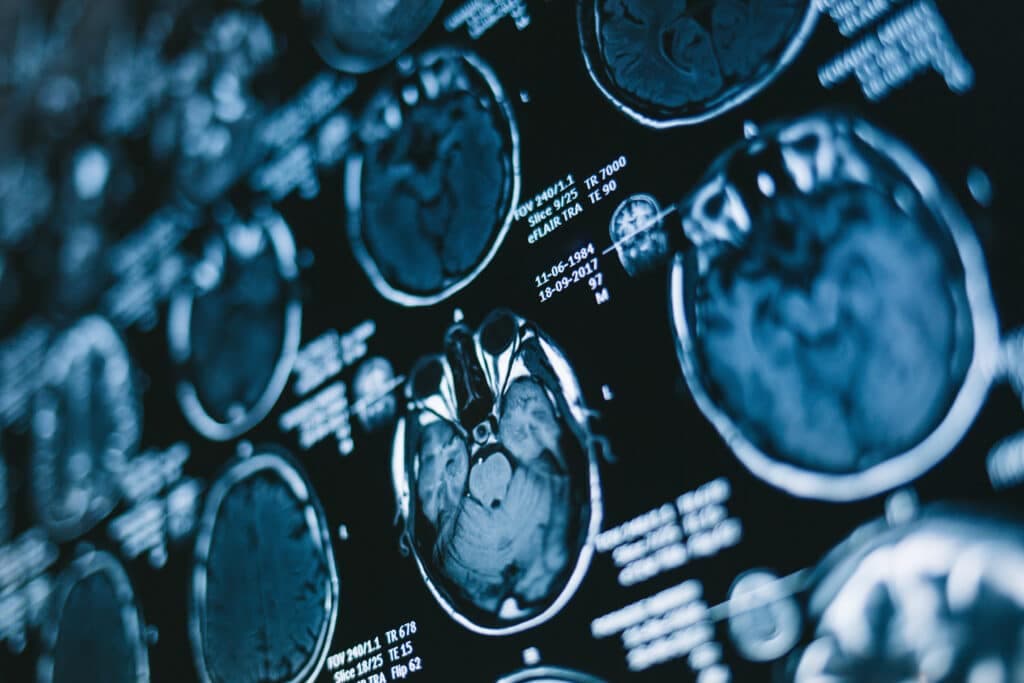 Brain magnetic resonance imaging scans
